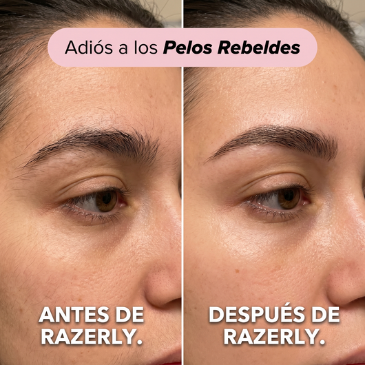 Maquinilla Eléctrica Facial 2 En 1 Razerly™